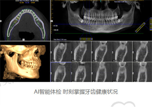 南京市口腔医院种牙多少钱一颗