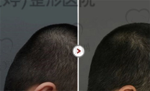 能做peek颅骨修补手术的医院