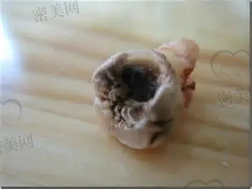 南宁哪家祛痘的医院好?找到非常适合您的祛痘专家! 南宁哪家祛痘的医院好?找到非常适合您的祛痘专家!