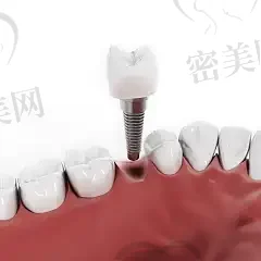 2023阜阳纯钛支架活动义齿口腔美容医院上榜清单TOP10(阜阳第二人民医院口腔科个个实力派,收藏不亏!) 2023阜阳纯钛支架活动义齿口腔美容医院上榜清单TOP10(阜阳第二人民医院口腔科个个实力派,收藏不亏!)