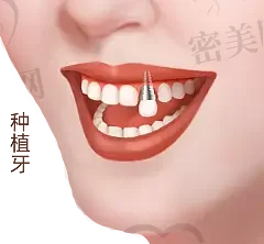 2023贵州牙齿向内倾斜矫正正规齿科医院评分前10位(贵州省第三人民医院口腔科知名度高口碑)