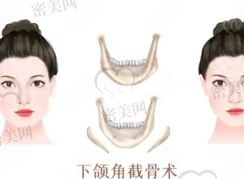 北京雅靓医疗美容的医生团队，技术大比拼