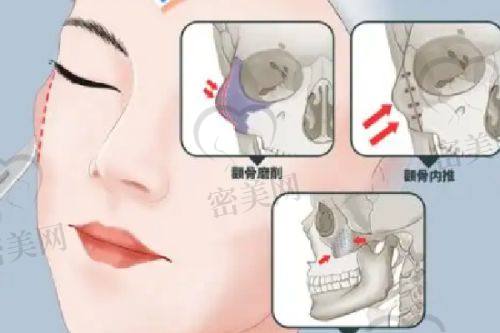 男科与去疤痕手术花费参考