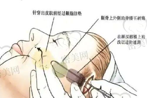 北京晶美医疗美容医院医生实力全解析