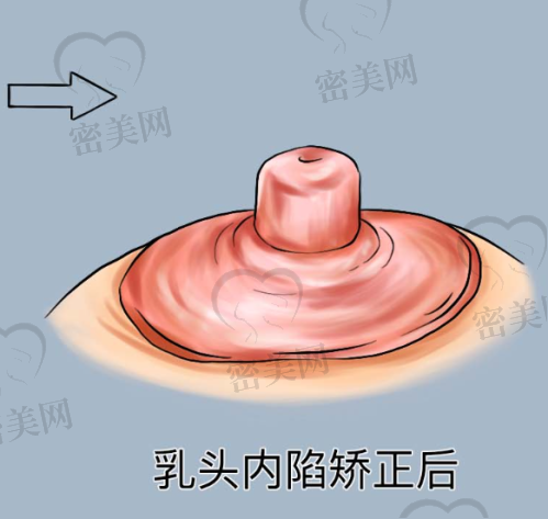 香港尚美整形中 心 - 赵伟豪医生