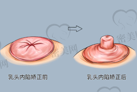 北京丰联丽格医生实力强吗？