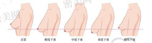 深圳华悦医疗美容医院