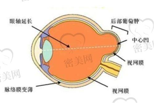 白内障手术多种晶体选择，价格从4000到3万都有