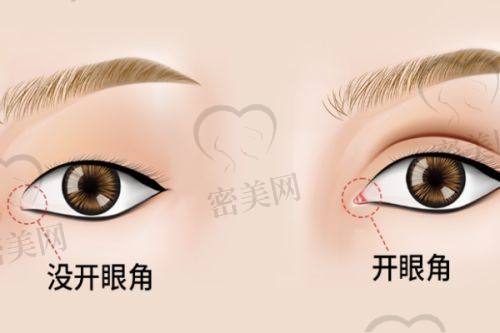 李旭光医生口碑怎么样？