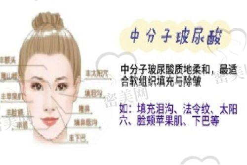 填充材料怎么选？