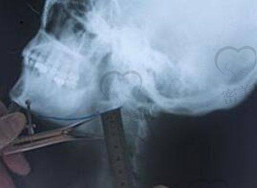 吴垠医生怎么预约挂号？