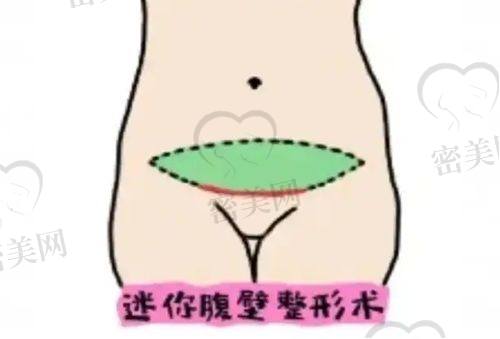 寇海东医生擅长项目：