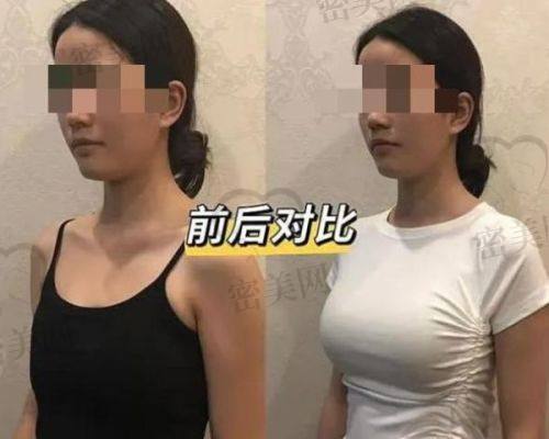 太原美都整形美容医院——张少军 医生助力