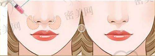 盛淼医生口碑怎么样？