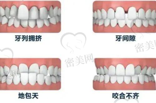 不同年龄段是否会影响矫正项目选择与报价？
