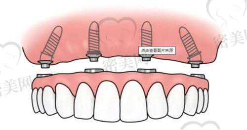 东莞道滘乐牙口腔｜连锁品牌实力派
