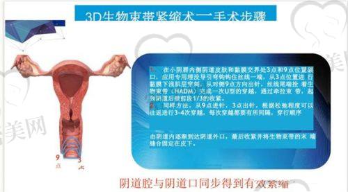 刘毅红医生怎么预约挂号？