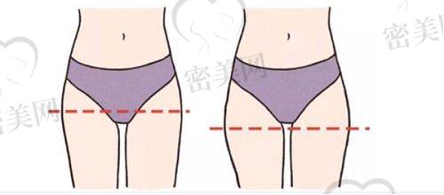 林建新医生怎么预约挂号？