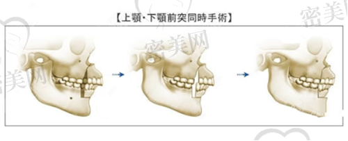 刘毅红医生擅长项目：