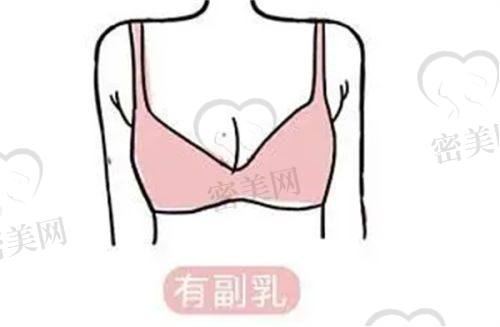 去法令纹的护肤品推荐