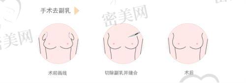 牟广隆医生执业信息：