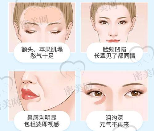 刘毅红医生技术特点：