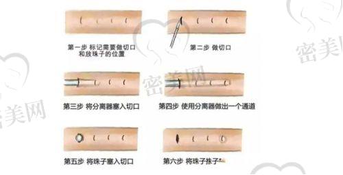 王丽丹医生技术特点：