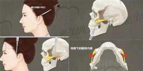 李贝医生擅长项目：