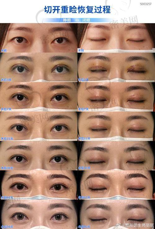 吉林瑞澳医学美容医院：自由选材，自主变得更美