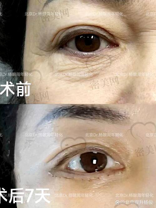 长春中妍奥克拉整形医院：大品牌下的品质输出