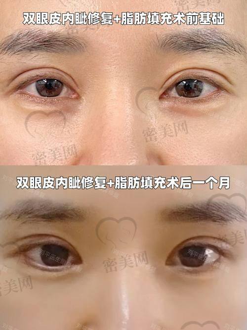 长春正韩医疗美容医院：韩式整形匠心传承