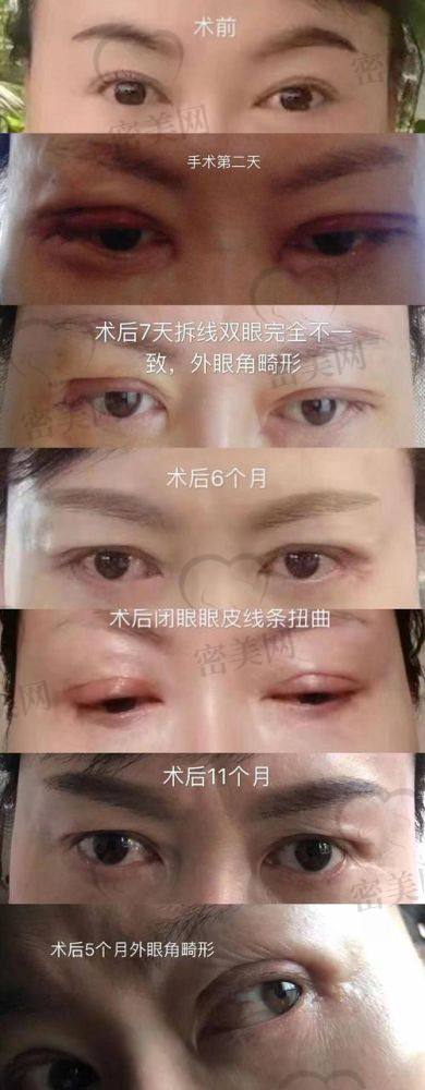 长春圣颜整形医院：个性化定制医生推荐