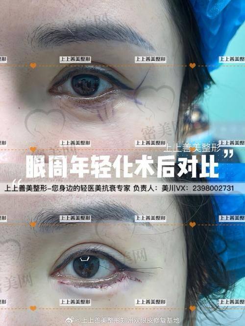 廊坊圣洁医院医美中 心