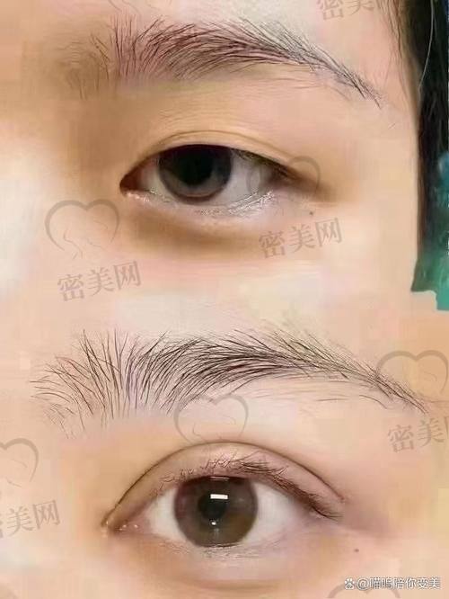 北京丰联丽格师丽丽医生：变得更美路上的“至佳拍档”！