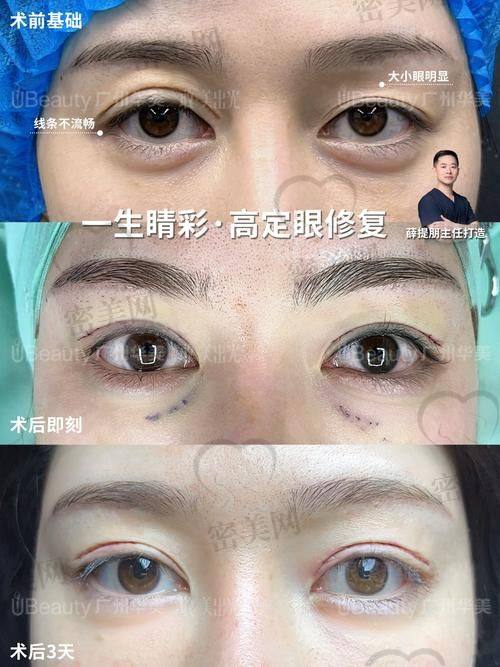 吴焱秋到底厉不厉害？技术优势全知道