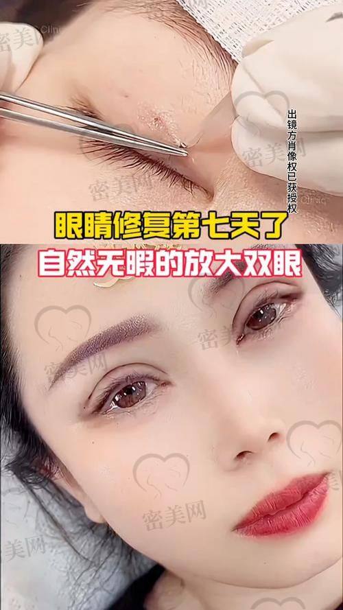 吴焱秋属于什么档次？技术优势大揭秘