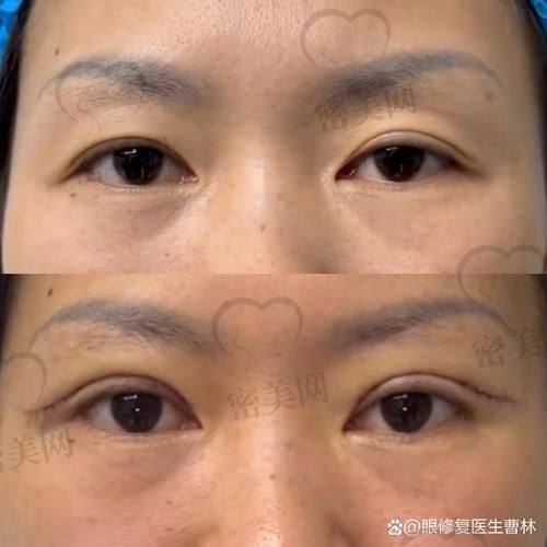 北京吴焱秋魏志香师丽丽谁更好？收费标准大比拼
