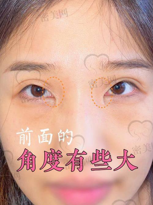 吴焱秋口碑怎么样？收费标准大公开