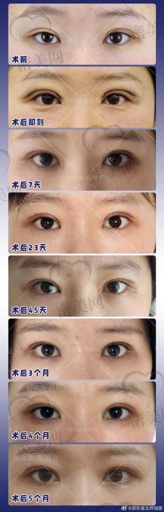 吴焱秋到底厉不厉害？实例成效见分晓