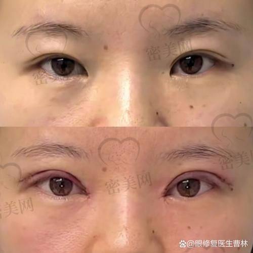 吴焱秋到底厉不厉害？医生信息大揭秘