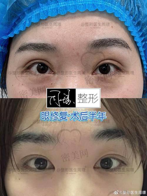 北京吴焱秋魏志香师丽丽谁更好？服务态度大揭秘