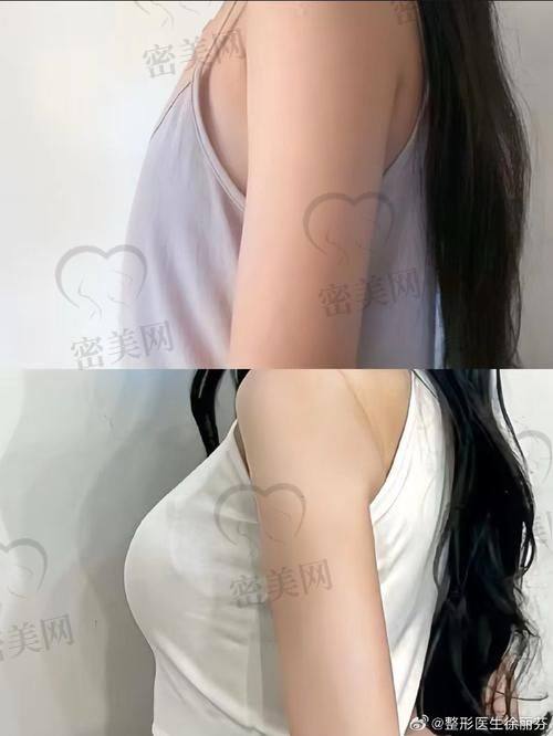 太原欧美莲整形美容医院——王新灿医生主理