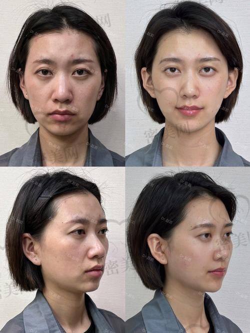 西安壹加壹医疗美容医院：王俊河医生的美丽密码