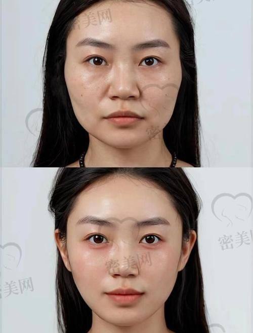 西安艺星医疗美容医院：赵颖医生的变得更美秘籍