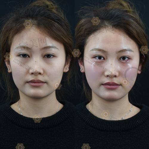 西安画美医疗美容医院：杨万忠医生的整形之道