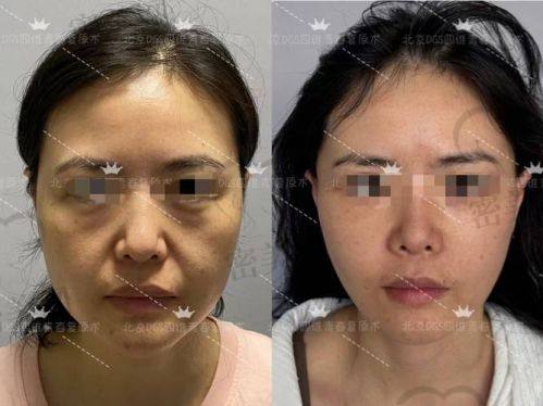 西安碑林西美整形外科门诊部：郭永华医生的整形魔法