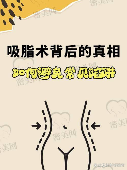 北京雅靓吸脂成效：让你惊艳到尖叫