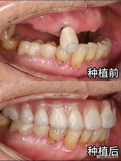 未来还会扩张吗？雅贝康正在重塑口腔连锁新格局