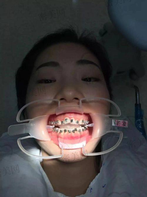 清华阳光口腔在武汉为什么那么受欢迎？