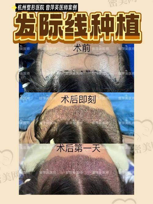上海艺星医疗美容：林沸腾医生的不错技艺
